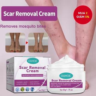  Kem xóa sẹo Kem xóa sẹo cũ cho chân Điều trị tẩy vết thâm Sẹo rạn da Sửa chữa chân Kem tẩy vết thâm - 29891701146.