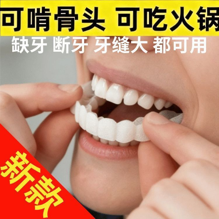 Niềng Răng Nẹp Niềng Răng Giả Đa Năng Niềng Răng Giả Vĩnh Viễn Niềng Răng Mô Phỏng Vỏ Ăn Xấu Xí Làm 