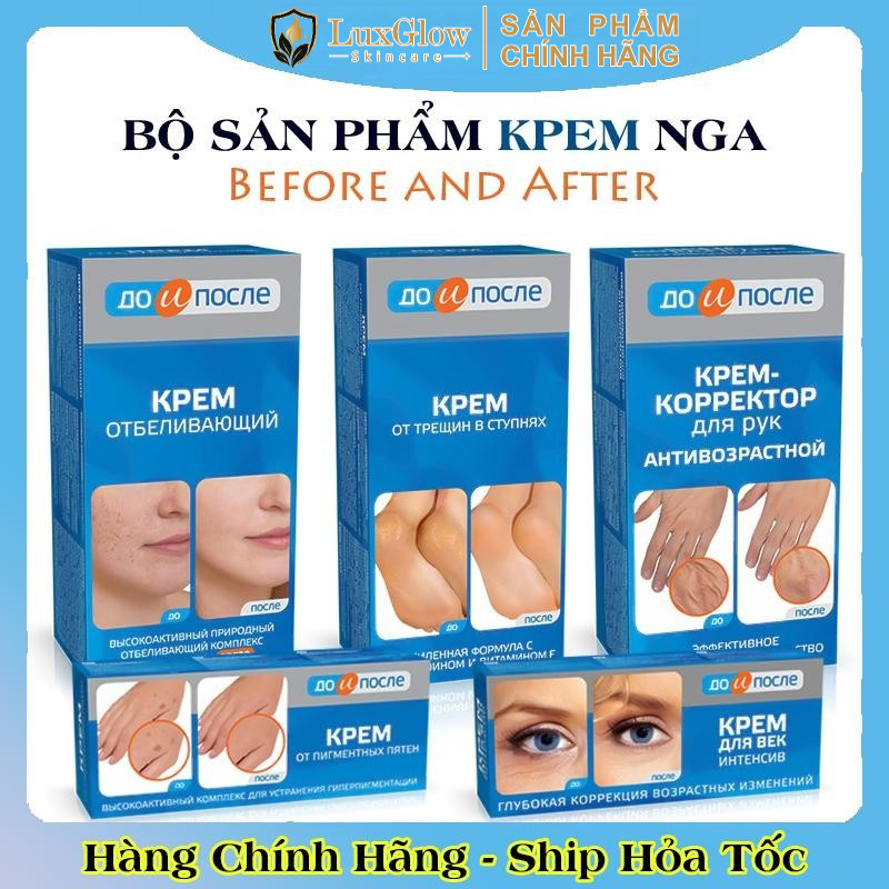 Kem bôi chống nứt gót chân, giảm đồi mồi, nhăn tay Kpem Nga Before and After