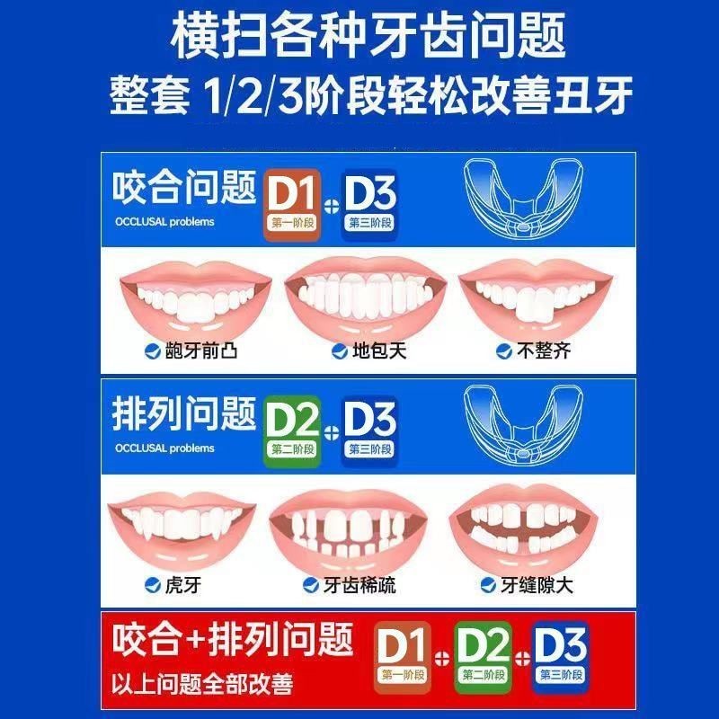 Liyue niềng răng Ống hút niềng người lớn stude Liyue Orthodontics Niềng răng trong suốt dành cho ngư