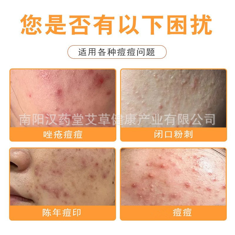 Dongtian Acne Removal Cream Acne Pit Mark Acne Rejuring Cream Acne Fade Acne Scar Care Cream88992662