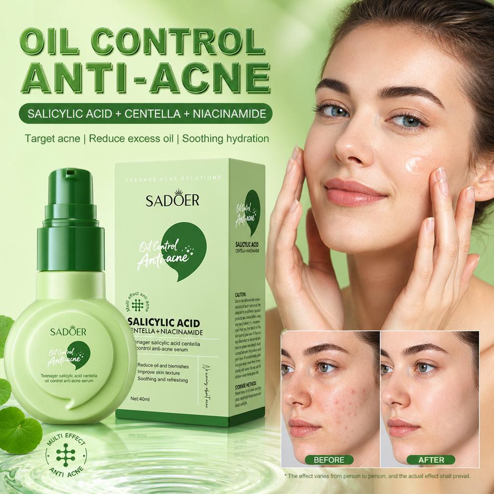 40ml SADOER Acne Serum Salicylic Acid Centella Asiatica Dầu Kiểm Soát Mụn Điều Trị Cho Thanh Thiếu N