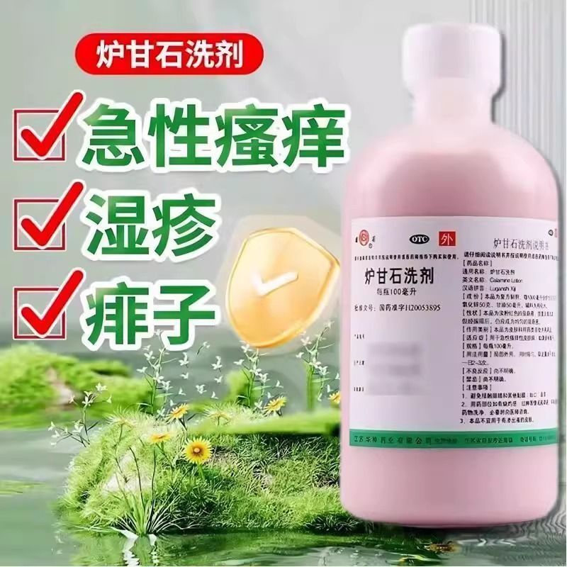 remai#Heat rash100ml Calamine lotion for redness, swelling, prickly heat, acute rashes, skin conditi