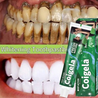 Gel nano bạc đánh bật cao răng sạch mảng bám trắng răng cho hơi thở thơm mát,  chính hãng 120g kem đánh