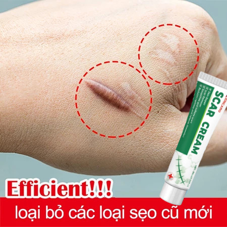 Xóa sẹo nhanh chóng