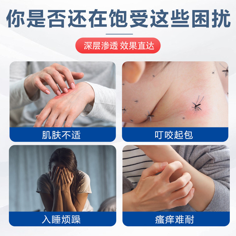 Hàng sẵn có Vận chuyển nhanh Kyoto Huixitang Itch-Relieving King Itch-Relieving Cream Red Rash Skin-