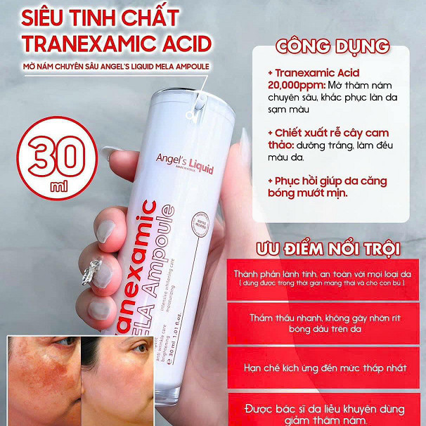 Serum Angel's Liquid Cải Thiện Thâm Nám - Angel's Liquid Tranexamic Mela Ampoule 30ml (Màu trắng)