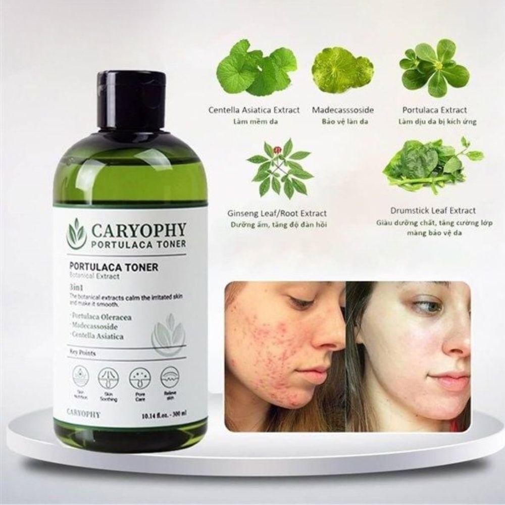 Ảnh 2 của Nước Hoa Hồng Caryophy Portulaca Toner Không Cồn Dành Cho Da Mụn Giúp Cân Bằng Và Làm Dịu Da 300ml