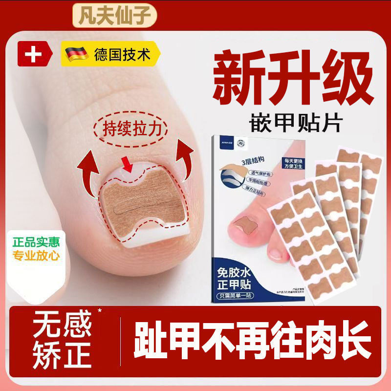 Chỉnh sửa móng tay Dụng cụ tiện dụng Viêm móng tay mọc ngược Miếng dán móng tay chuyên dụng Móng châ