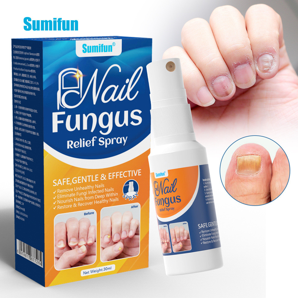 Sumifun Onychomycosis Care Spray Onychomycosis Care Liquid External Nail Spray K000