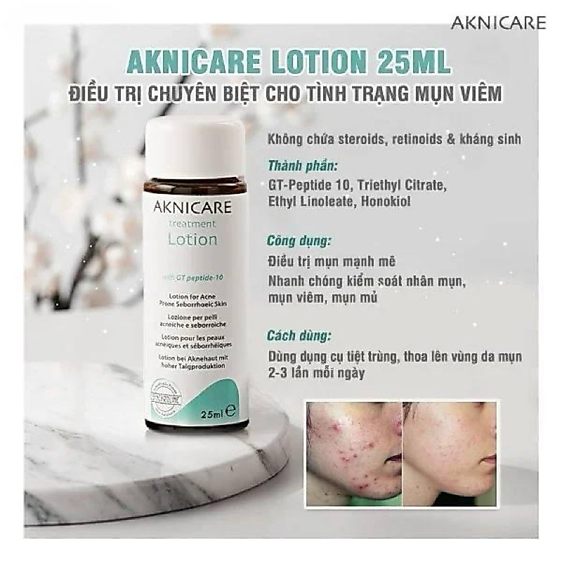 AKNICARE LOTION TREATMENT GIẢM MỤN VIÊM, MỤN MỦ 25ml