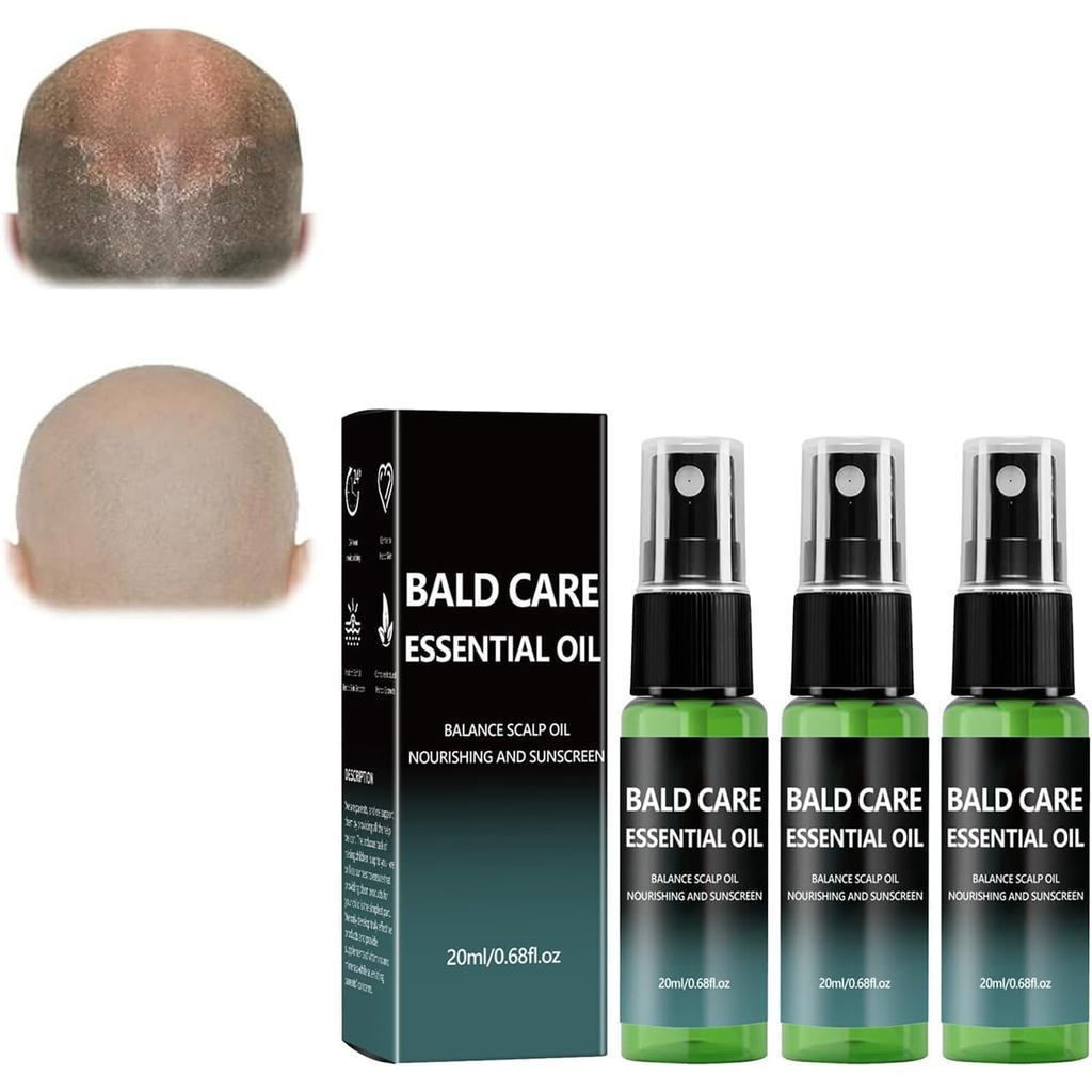 Được sử dụng để nuôi dưỡng tinh dầu rụng tóc, 20ml. Kem dưỡng ẩm da đầu dành cho nam, Chăm sóc hàng 