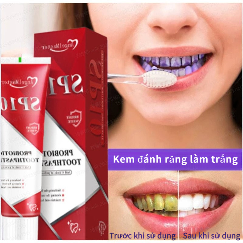 【Bảo Vệ Nướu/Trắng Răng】SP10 - Kem Đánh Răng Làm Trắng Men Vi Sinh/Kem Đánh Răng Làm Trắng Probiotic