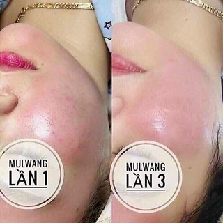 Mulwang x5 căng bóng da Hàn Quốc