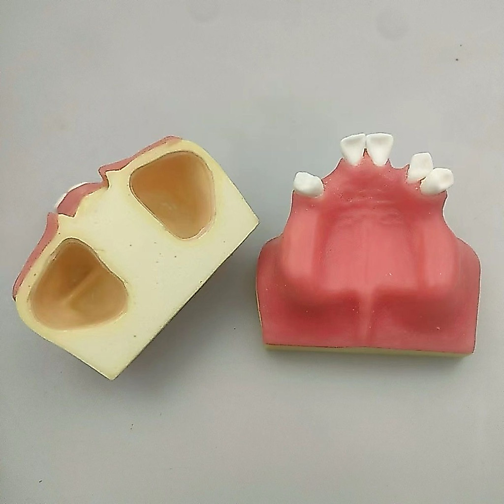 HÀM CẮM IMPLANT | HÀM MÔ HÌNH THỰC HÀNH IMPLANT