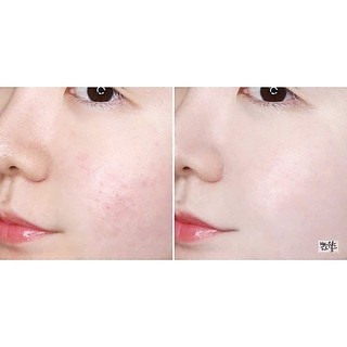 Kem dưỡng trắng da Dr.Jart+ V7