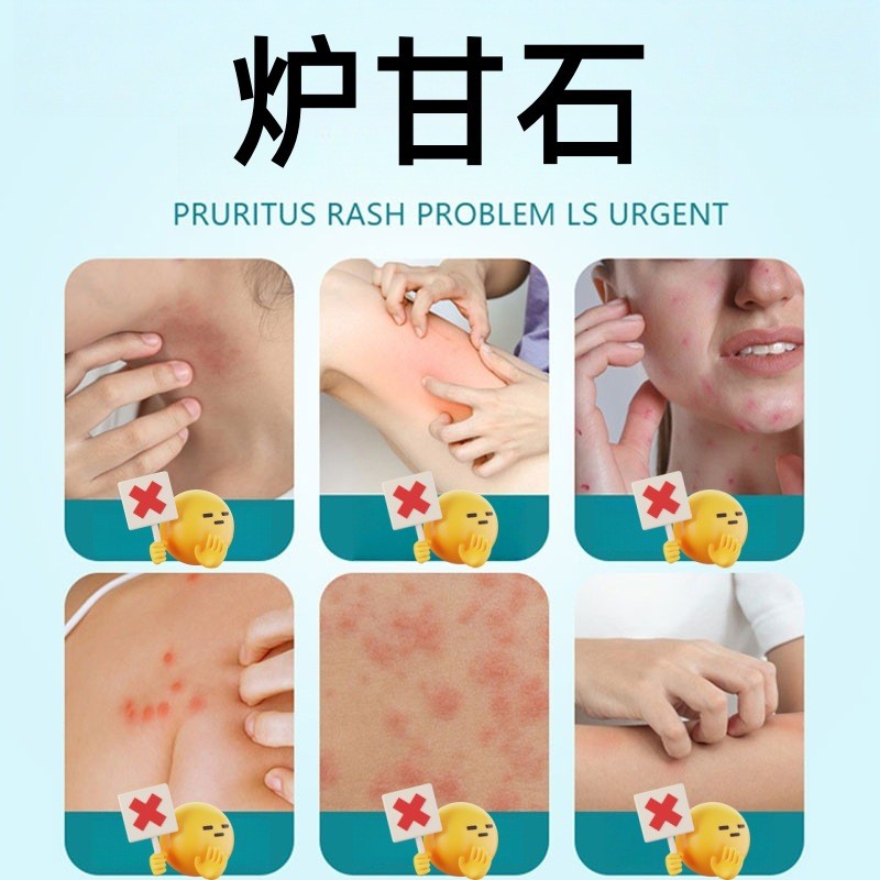 Hàng sẵn có Giao hàng nhanh Jingmei Dược phẩm thảo dược Lò Ganshi Skin Ứng dụng bên ngoài Kem toàn t
