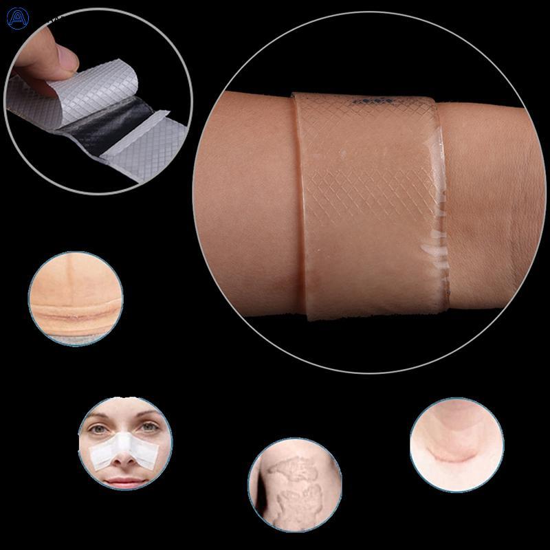 [JCAAAP] Trị Liệu sẹo Loại Bỏ Chấn Thương Đốt Silicon Miếng Dán Gel Hỗ trợ giảm mụn Có Thể Tái Sử Dụ