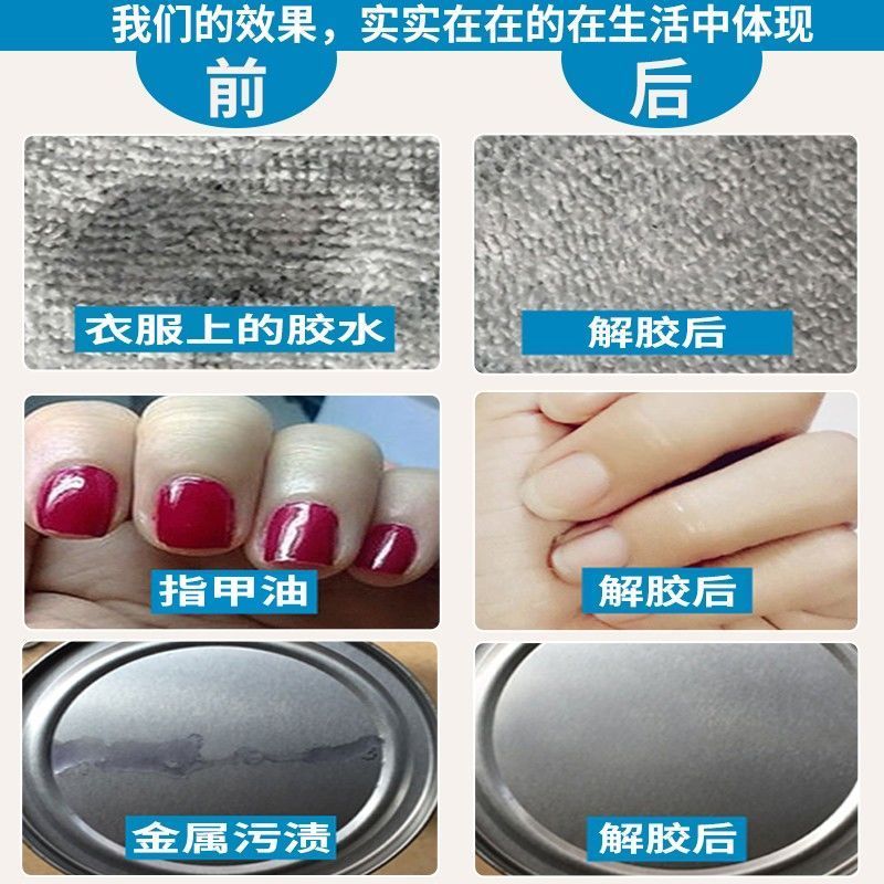 Keo Tẩy 502 Đa Năng Keo Tẩy Acetone 401 Keo Degumming 101 Nhanh Khô Tức Thì Keo Tẩy Móng Tay Siêu Ke