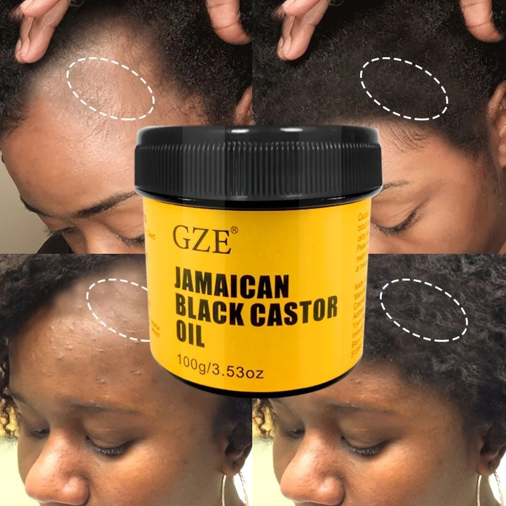 Dầu thầu dầu đen GZE JAMAICAN ép lạnh nguyên chất cho tóc Gro