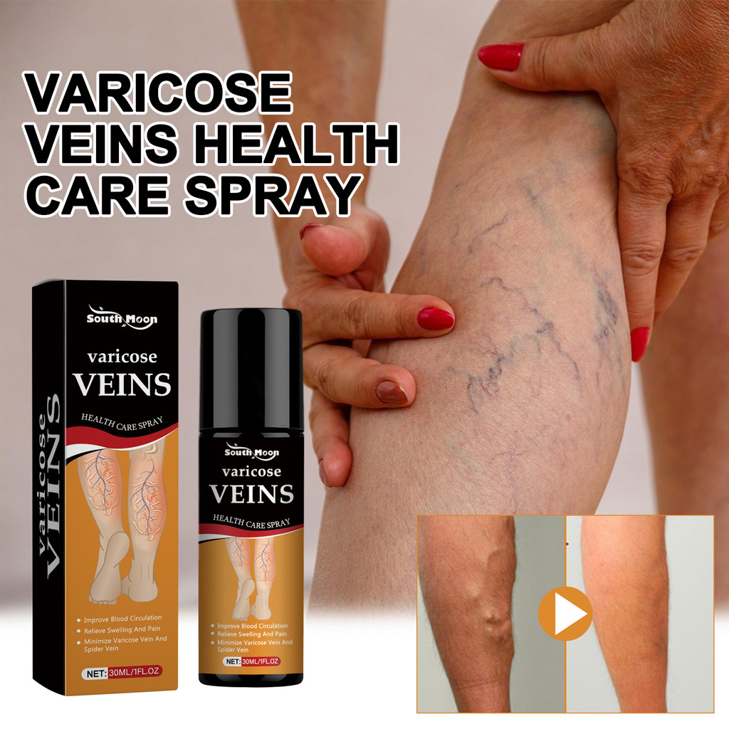 South Moon Vein Care Spray Relieve Leg Muscle Massage Gentle Comfort Care Spray
