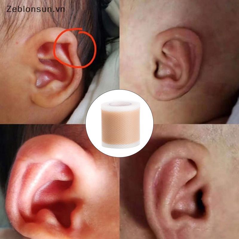 # HB # Baby Ear Corrector Trẻ sơ sinh Protruding Ear Correction 4 x 50cm Silicone Kids Ear Corrector
