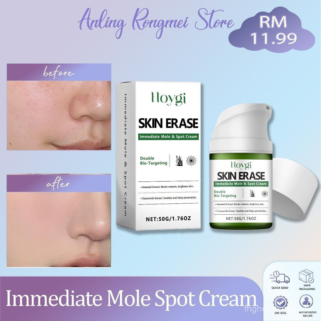 Hoygi Immediate Mole Spot Cream 50g Skin Erase Mole & Spot Cream Brightening Moisturizer Cream Brigh