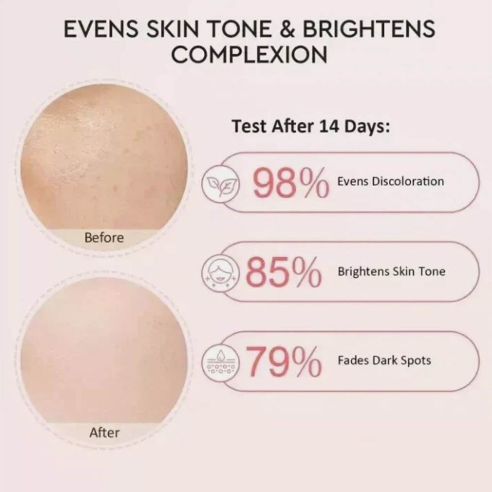 Glad2Glow Niacinamide Face Serum 17ml, Fast‑Absorbing Formula For Morning Night Full Facial Skin Car