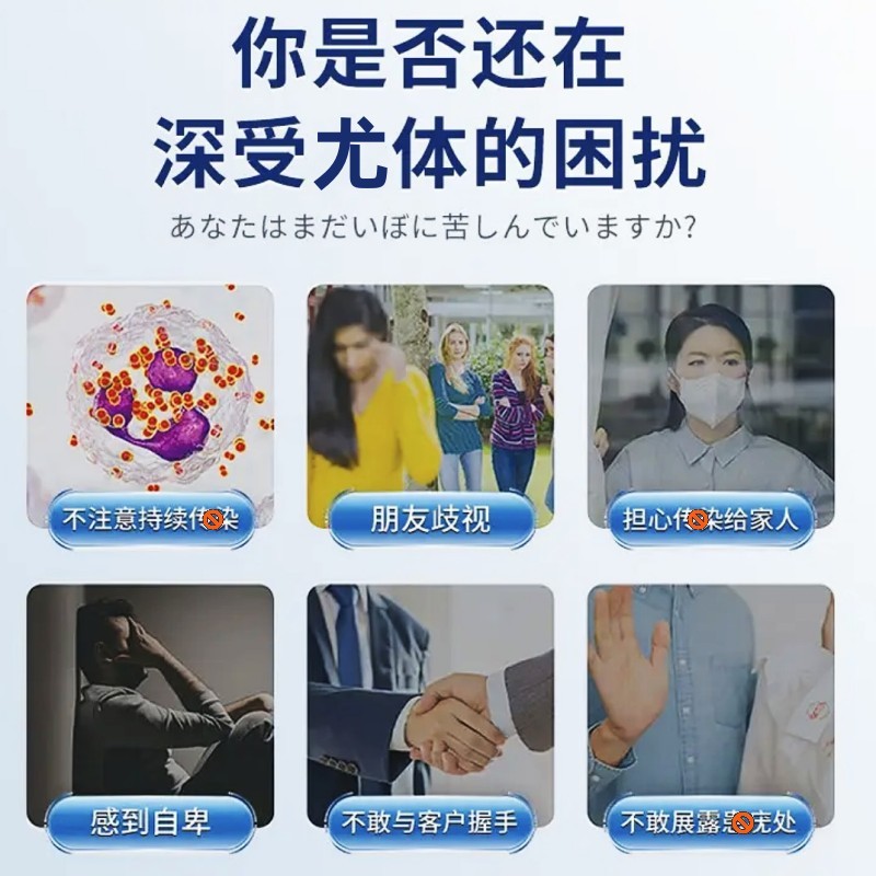 Hàng sẵn có Giao hàng nhanh như Knoke Wart Clearing Cream Kyo Cream Filamented Euro External Use Mic