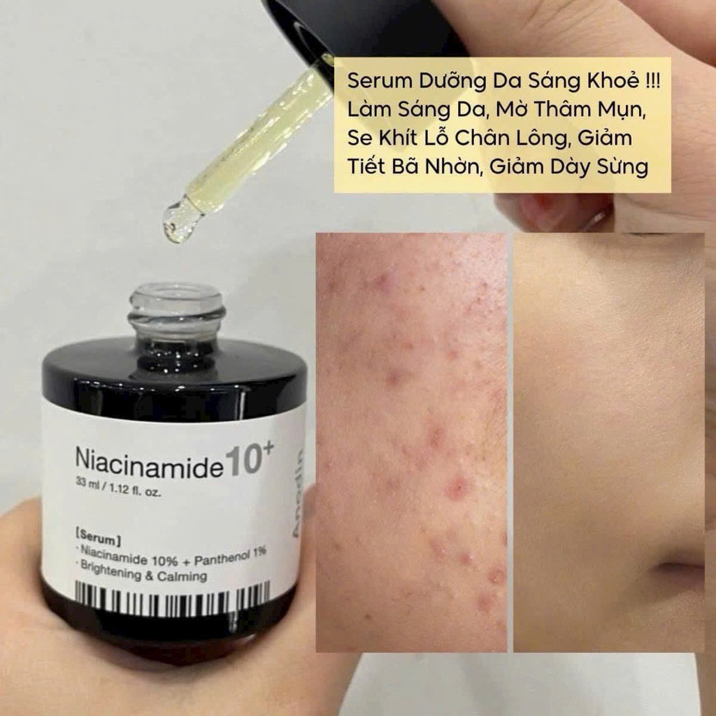 Tinh chất Anodin Niacinamide 10 Plus 33ml, dưỡng trắng, mờ thâm