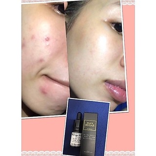 Serum đường đen BLACK SUGAR