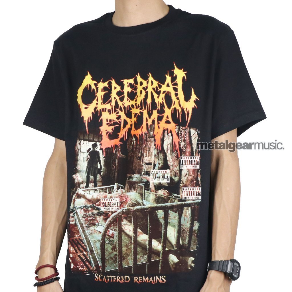 Áo thun Cerebral Edema - Còn lại