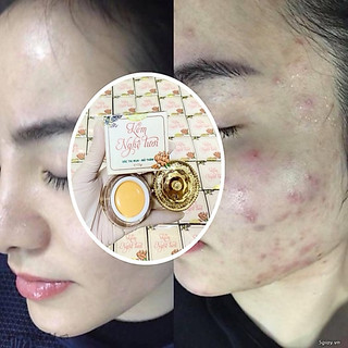 KEM FACE NGHỆ TƯƠI 15gram