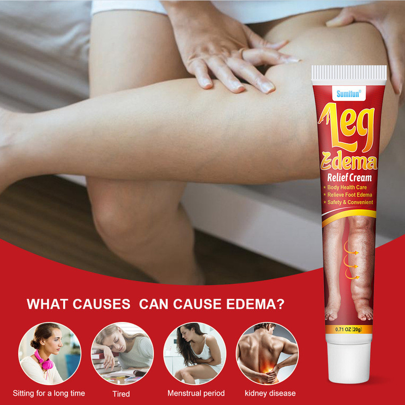 Hàng sẵn có Sumifun Edema Kem dưỡng da đứng lâu sau chân Kem Massage sử dụng bên ngoài K10162