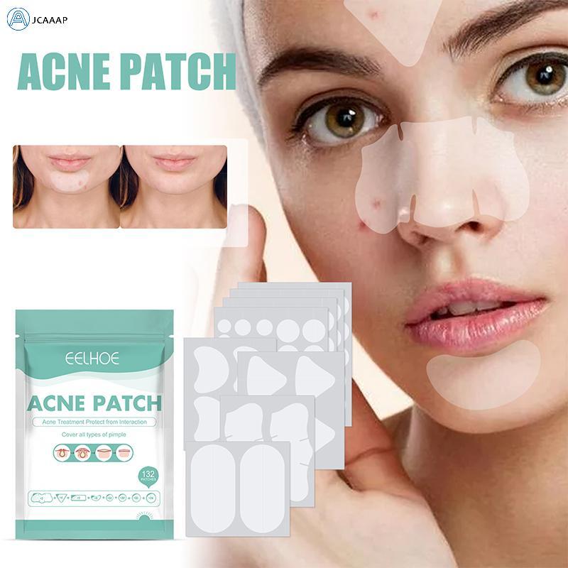 [JCAAAP] 132 Cái / 8 Tờ Miếng Dán Mụn Mụn Miếng Dán Stiers Miếng Dán Điều Trị Điểm Mụn Miếng Dán Vết