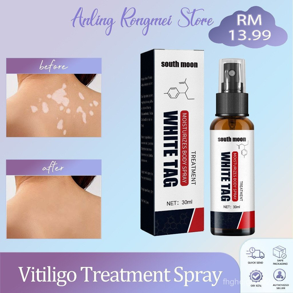 【In Stock】South Moon Vitiligo Treatment Spray 30ml White Tag Treatment Remover Skin White Spot Tag W