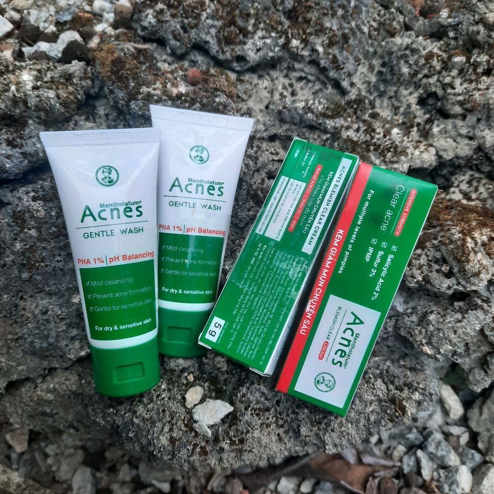 Bộ 4 acnes giảm mụn : 2 gel giảm mụn acnes 5gam & 2 sữa rửa mặt acnes 25gam/ tuýp