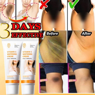 Kem chống thâm kem làm trắng nách Kem dưỡng trắng da Vitamin C 60g Vùng kín, đầu gối, làm trắng khớp đen,Loại bỏ melanin
