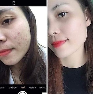 Combo kem Collagen plus vit E