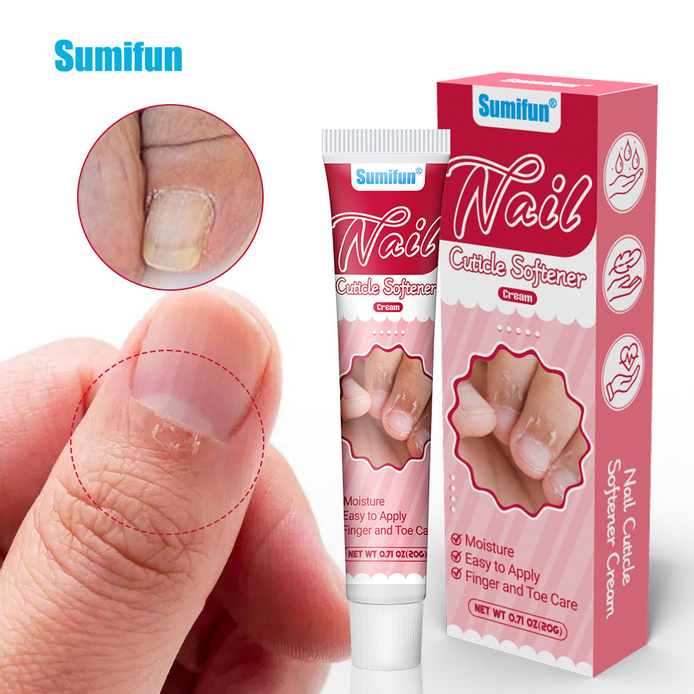 Sumifun Cream Nail Dead Skin Softening Cream Cracked Hands Foot Care Cream k10152260703
