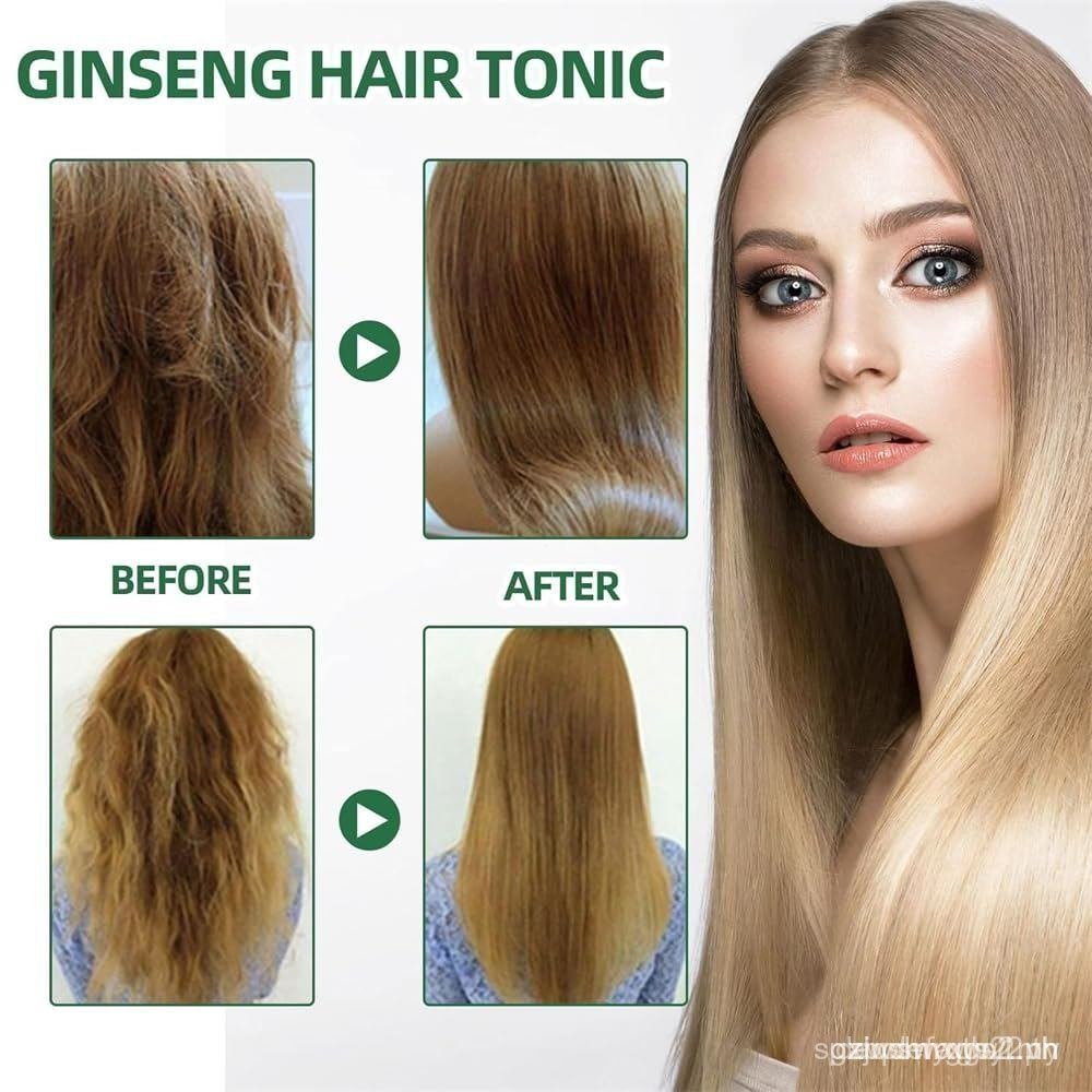 2 Xịt Tăng Trưởng Tóc Ouhoe, Dành Cho El Crecim Storage Del Cabello, Ouhoe Ginseng Hair Regrowth Ser
