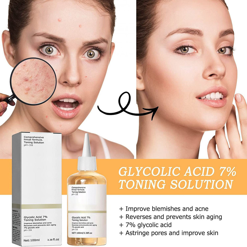 ((6 Chai) Mực Axit Trái Cây Ethanol 100ml, Loại Bỏ Mụn Dưỡng Ẩm Da, 7% Glycol Acid Ethanol Rejuvenat