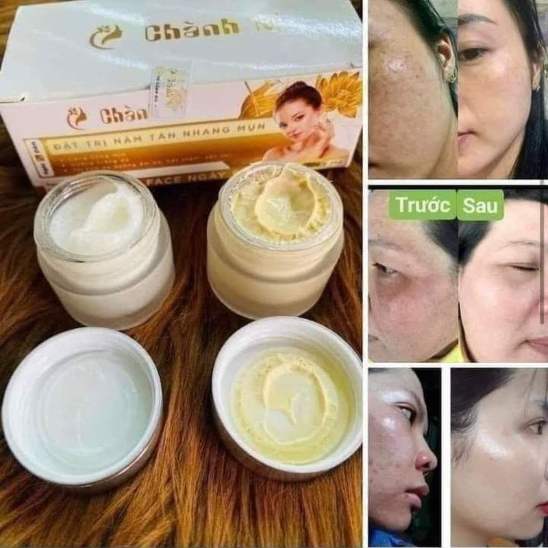 Daigou Vietnam Cream Set Face Skin Care Day Night Wear Kem chanh ni ngày y + dem7.15