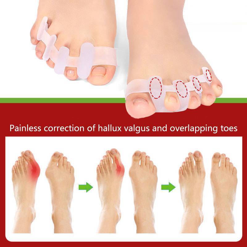 # sepsale # 1 Cặp Dụng Cụ Tách Ngón Chân Thích Hợp Chất Liệu Bunion Corrector Gel Mềm Miếng Đệm.