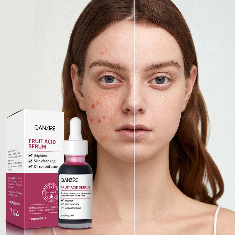 #New Product essence Calluses Fruit Fruit Acid Softening Anti-Acne Serum Essence acid Moisturizing a