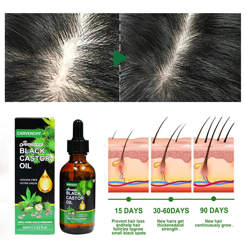 Hàng sẵn có Giảm giá Dầu thầu dầu đen Jamaica hữu cơ lạnh Dầu thầu đen Jamaica0813