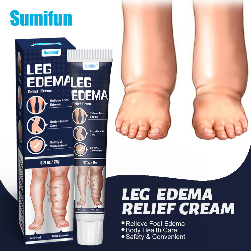 Sản phẩm mới sumifun Kem Miếng Dán Edema Patch Chân Nổi Edema Chăm Sóc Bàn Chân Sumifun Sức Khỏe k10