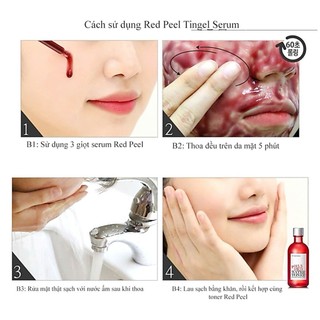 Tinh chất SO NATURAL (Peel Serum/ White Serum)