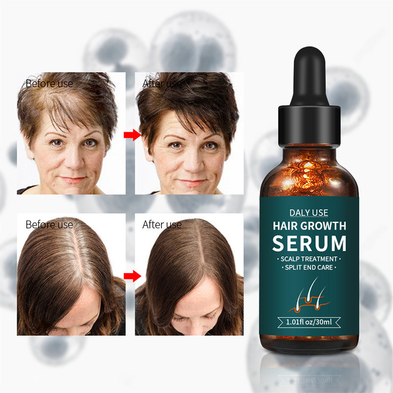 Giải pháp tăng trưởng tóc Tonic Hair Tonic