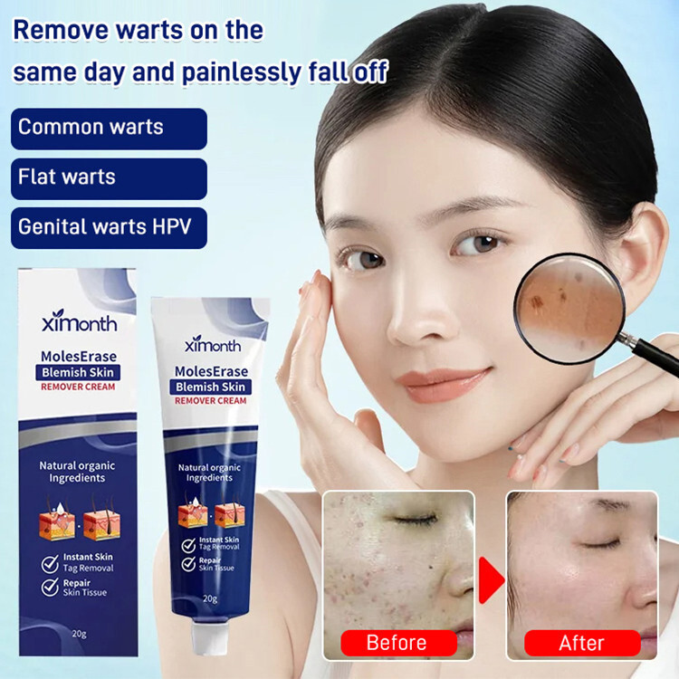 ◈ 🍒☆Kem chăm sóc mụn cóc Làm sạch da nốt ruồi Thịt Grain Repair Fade Wart Fade Cream